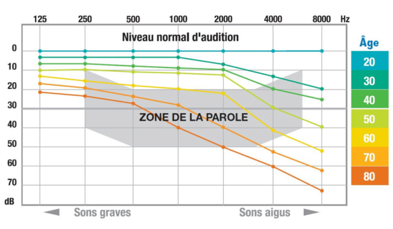 Courbe audiométrique : un outil indispensable pour évaluer la perte d'audition